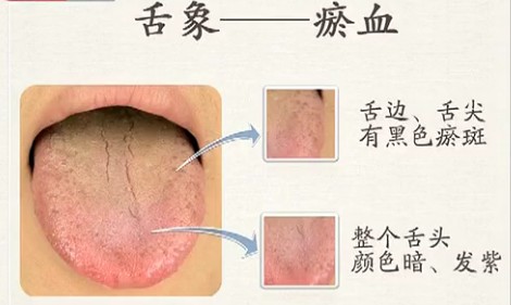 珍贵的舌诊图谱!太全了！知识就是宝藏！必须转了！