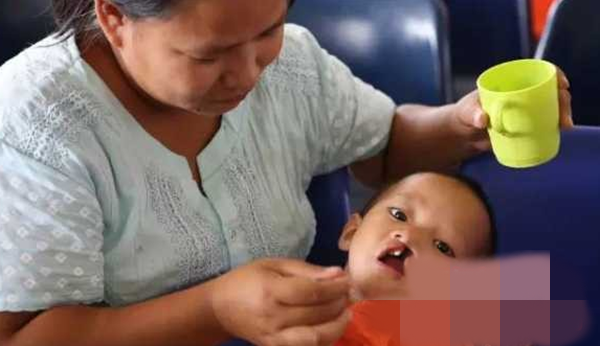 缅甸唇腭裂患者能免费进行手术了！