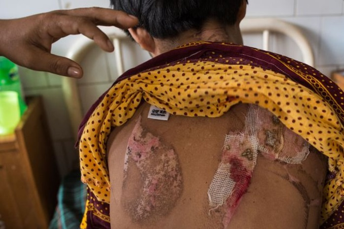 缅甸13岁女童工被熨斗烫 每周收入不到70元