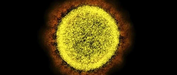 震惊全球：炸了! 新毒株XE问世,传播恐快10%,637人中招! 近30%感染者四肢疼痛,苦不堪言!