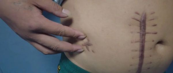 冒死从缅北逃回后，他们讲述了惨痛遭遇…