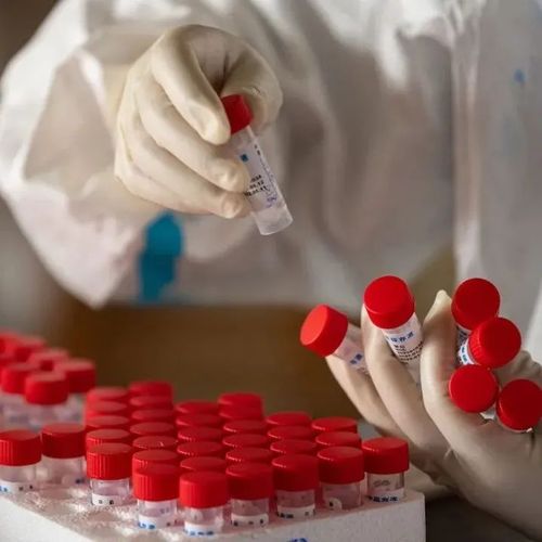 “长期新冠”后遗症？专家：多数是短暂的，症状轻微