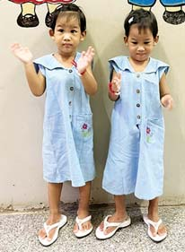 在仰光儿科大医院成功进行连体婴分离手术后孩子们正健康成长